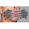 Baillon Block Lips Métal Baillon Block Lips Métal